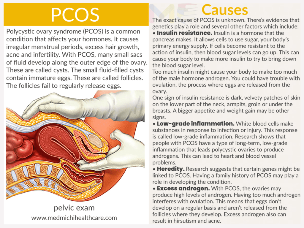All Disease Causes Short Notes 13 Pcos