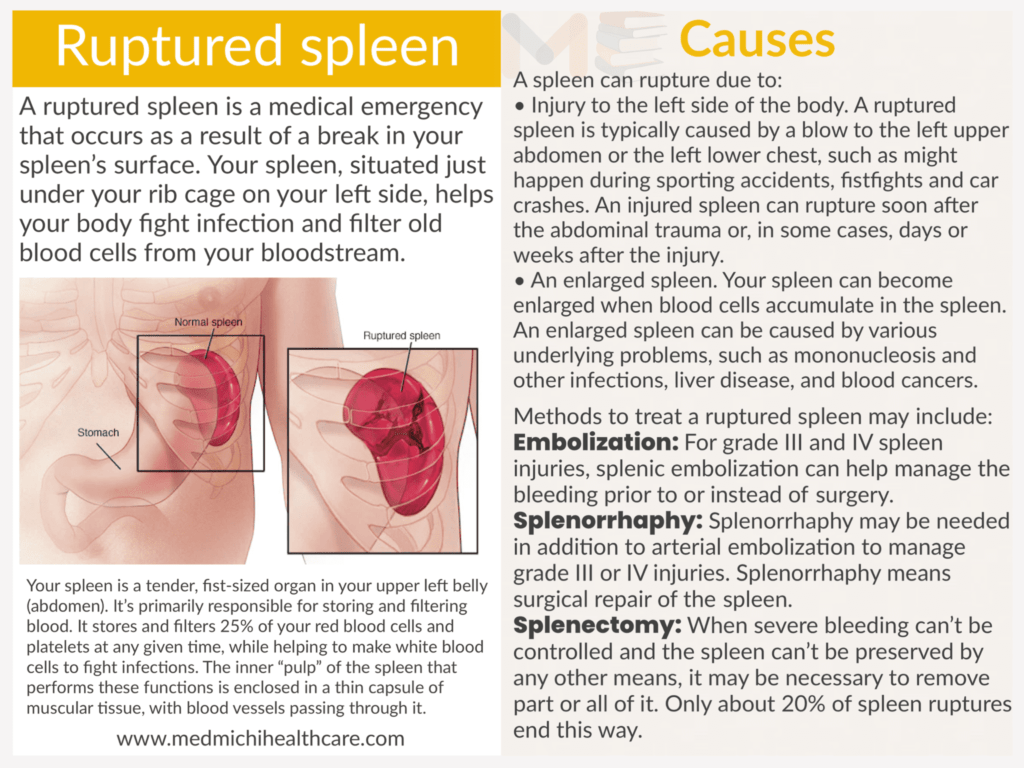 Ruptured spleen