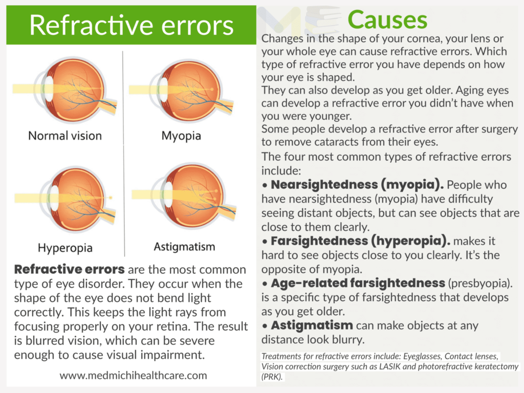 Refractive errors​