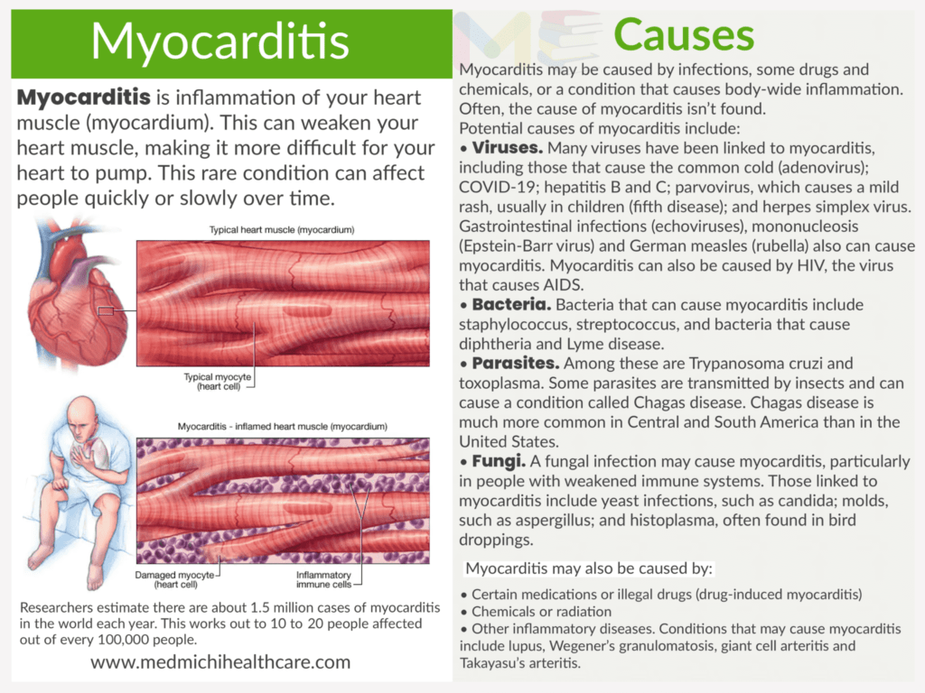 All Disease Causes Short Notes 18 Myocarditis