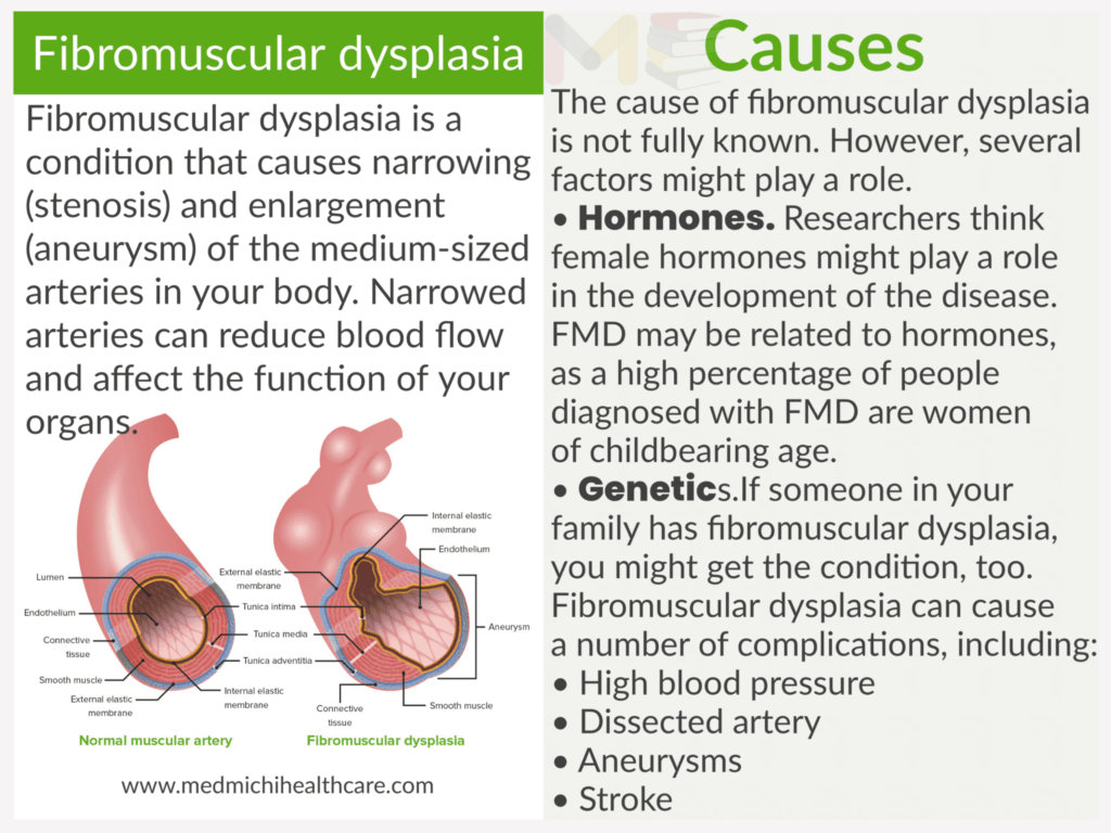 Fibromusculat dysplasia​