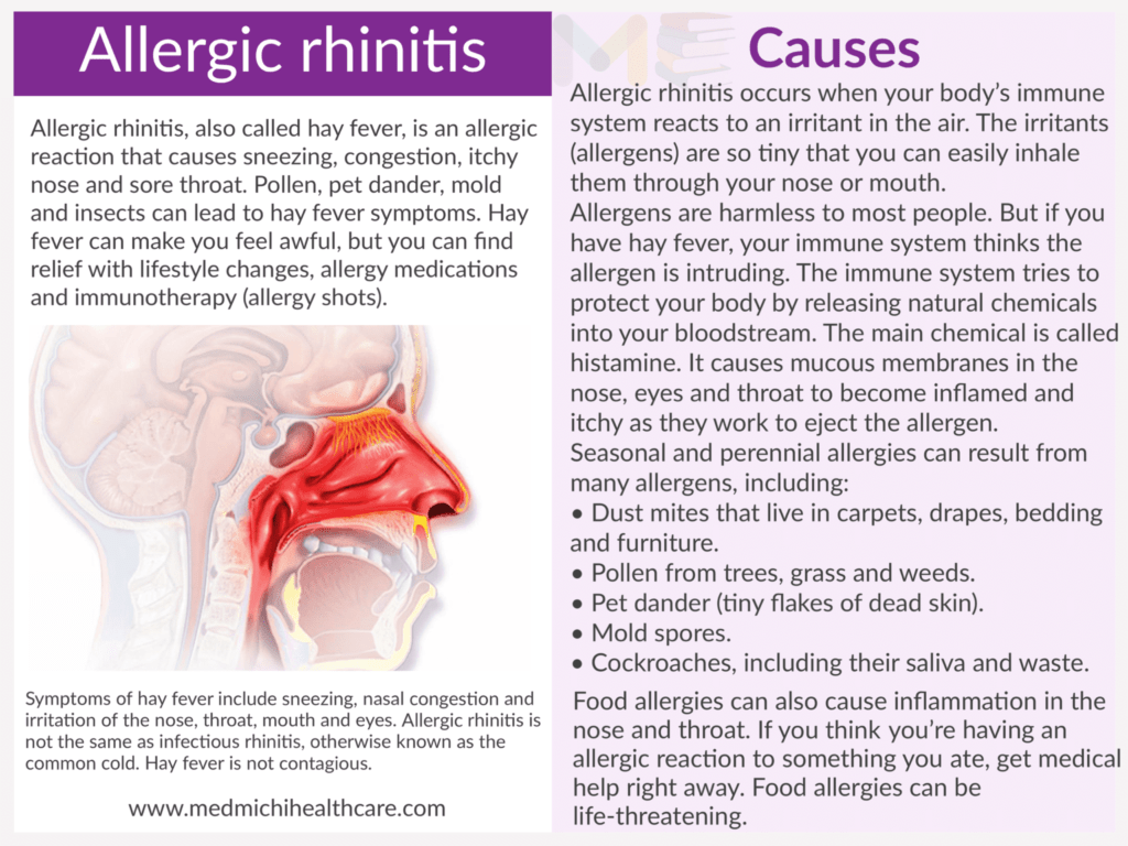 Allergic rhinitis ​