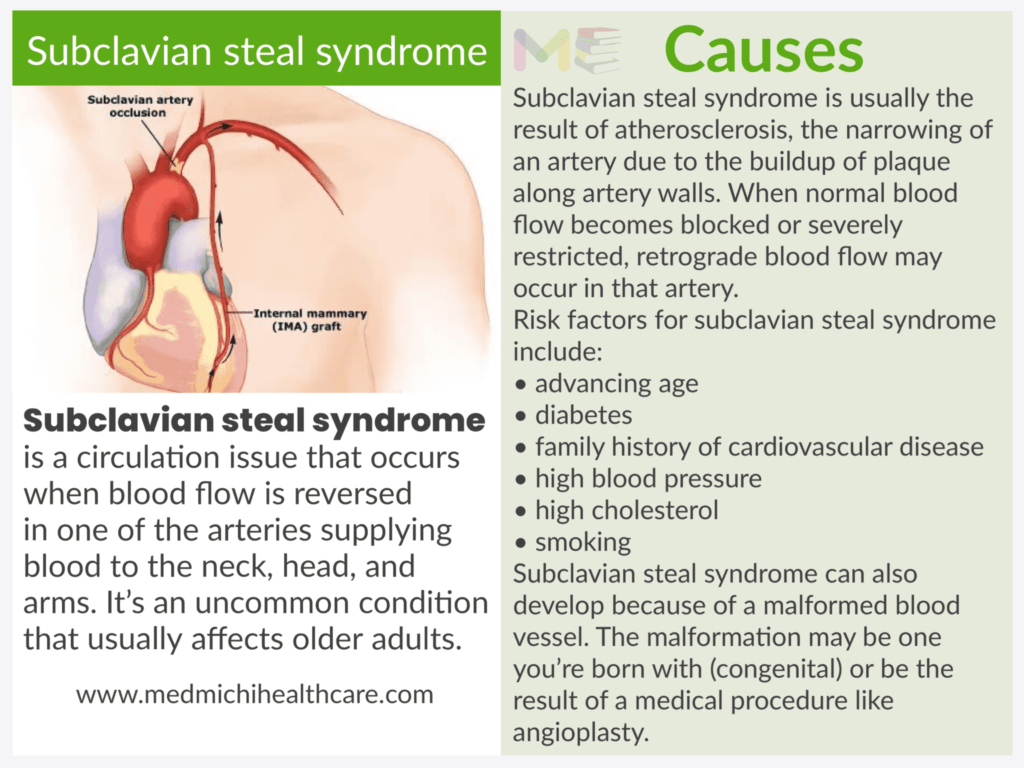 Subclavian steal syndrome ​