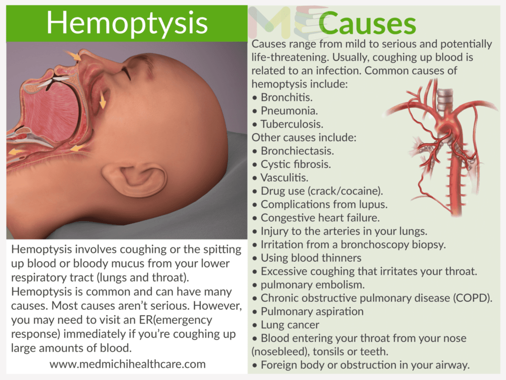 Hemoptysis​