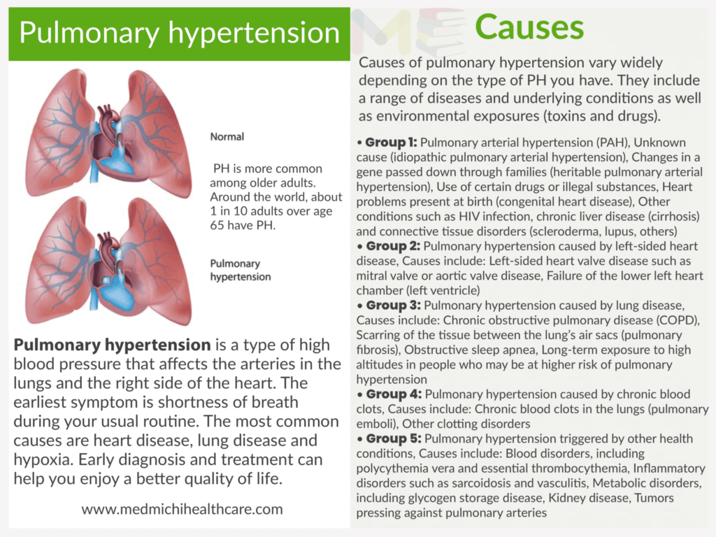 Pulmonary hypertension 