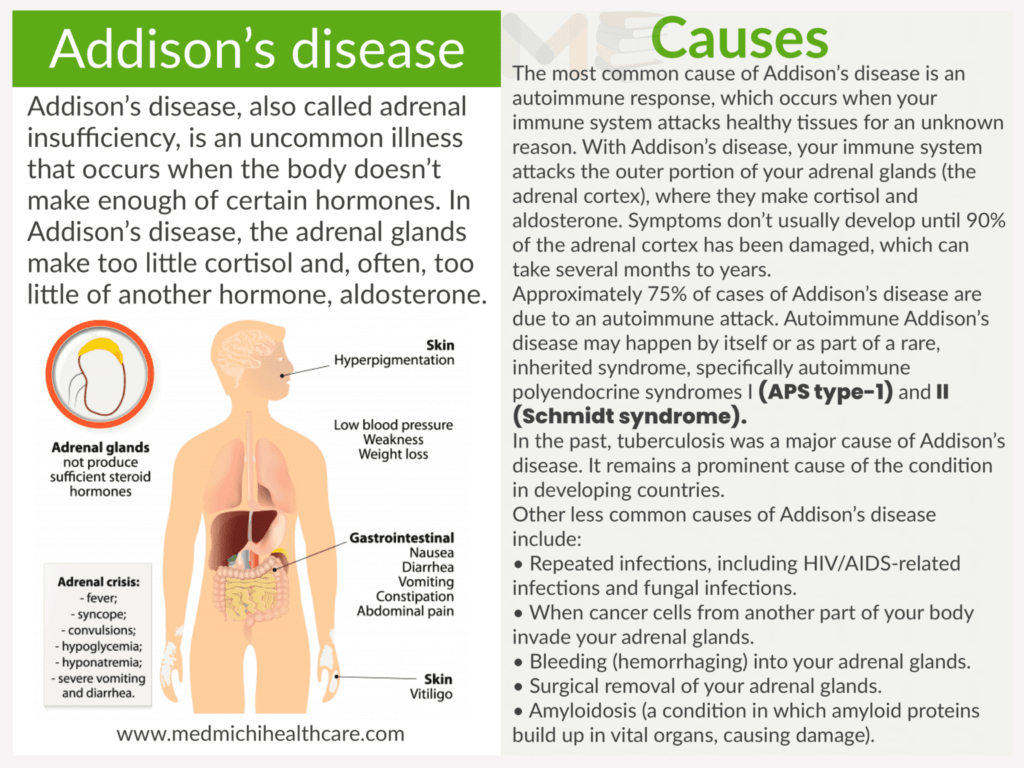 Addison’s disease​