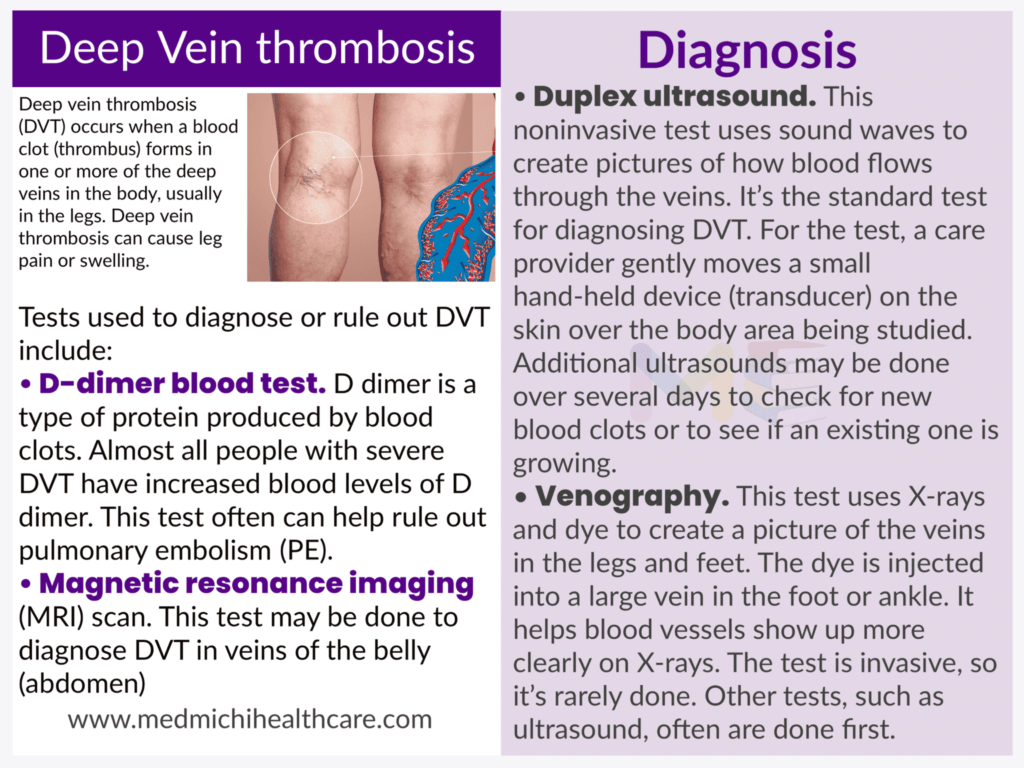 Deep vein thrombosis 