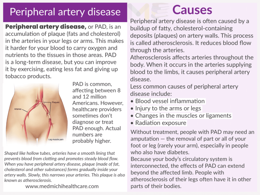Peripheral artery disease ​