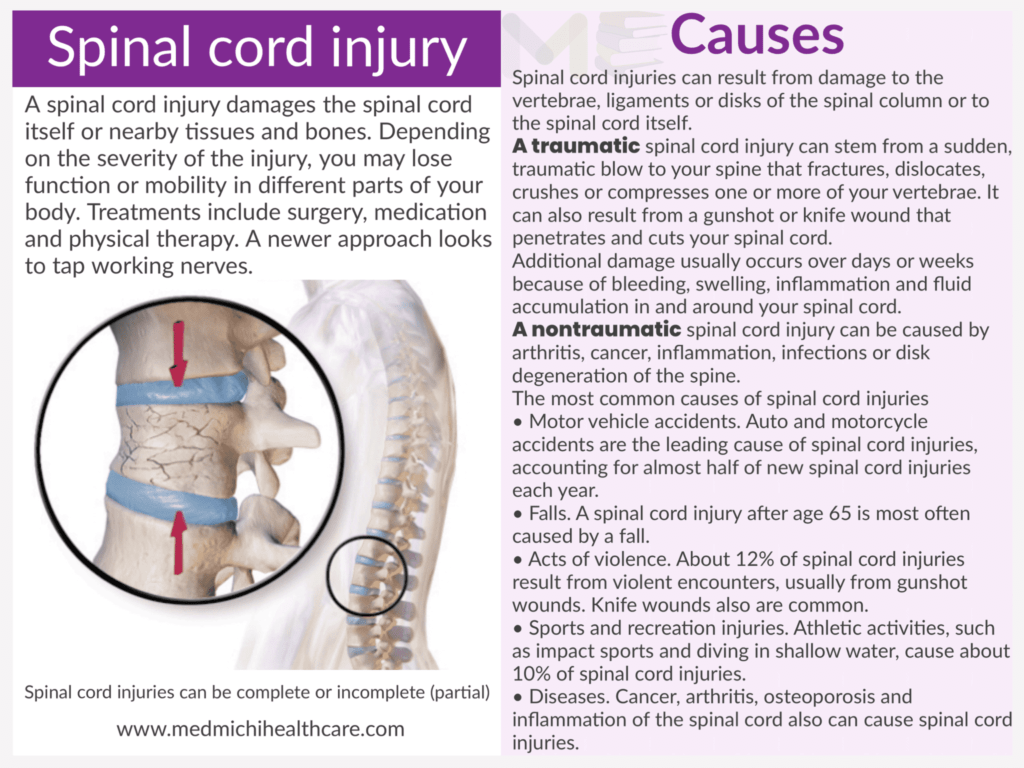 Spinal cord injury ​