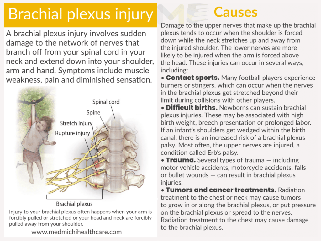 All Disease Causes Short Notes 3 Branchial plexus injury