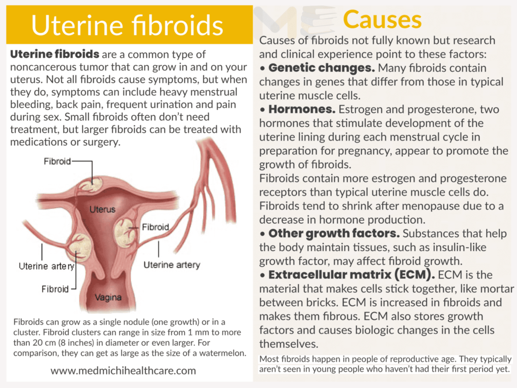 All Disease Causes Short Notes 15 Uterine fibroids 