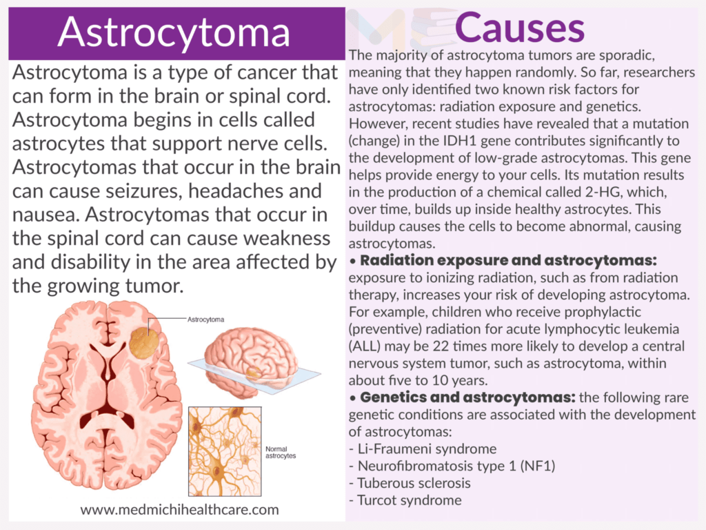 Astrocytoma