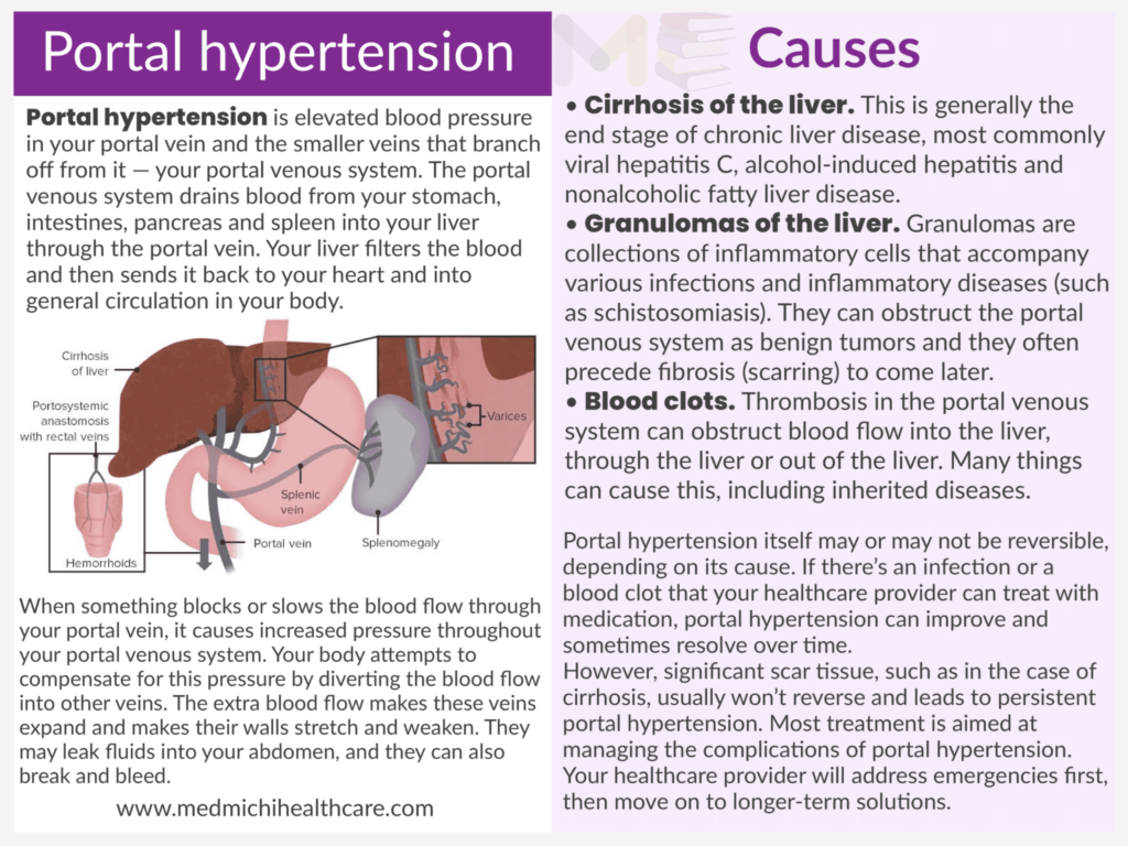Portal hypertension ​