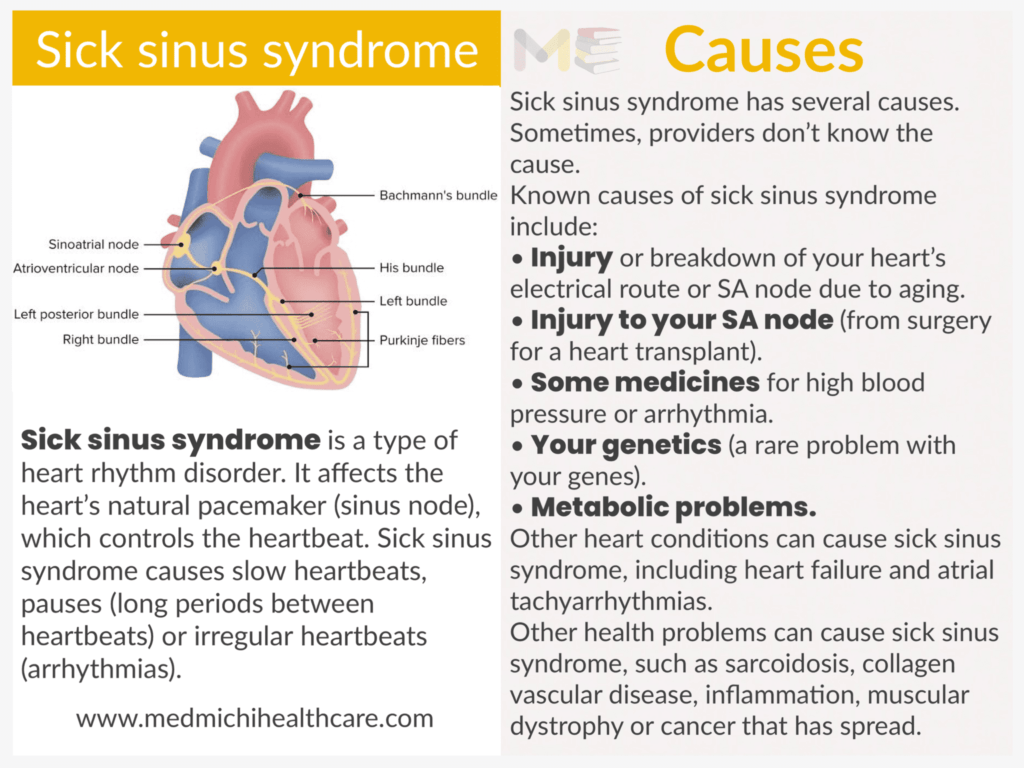 Sick sinus syndrome ​