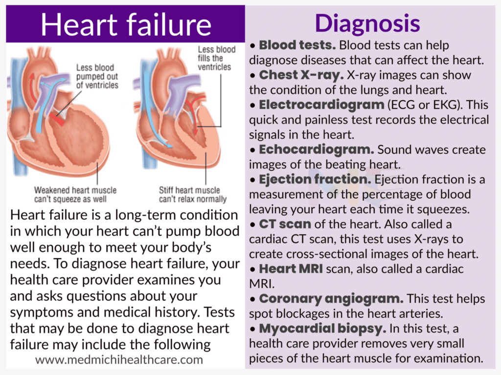 Heart failure 
