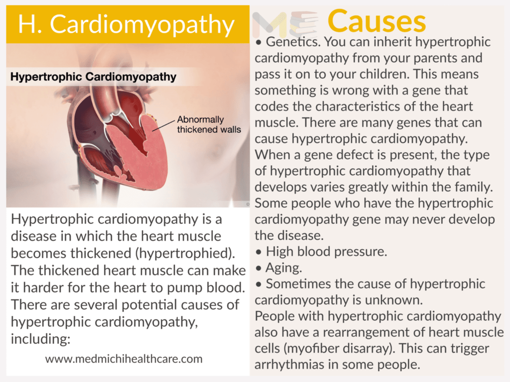 Hypertrophic cardiomyopathy ​