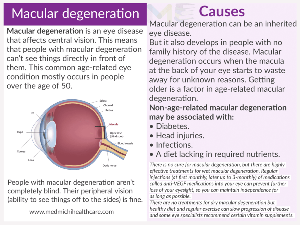 Macular degeneration ​