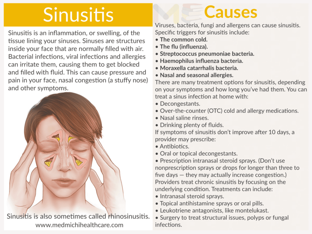 All Disease Causes Short Notes 18 Sinusitis