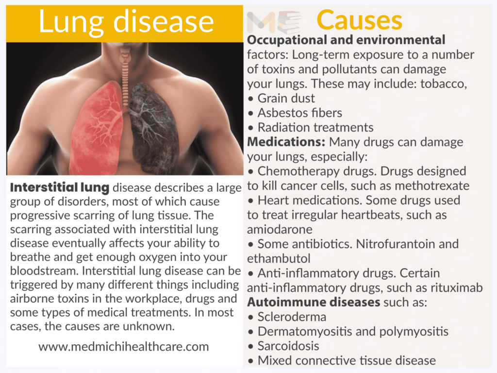 Lung disease