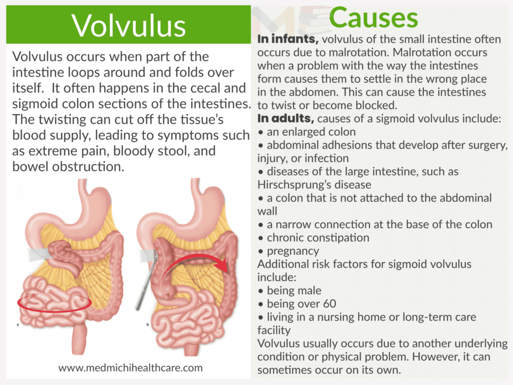 Volvulus
