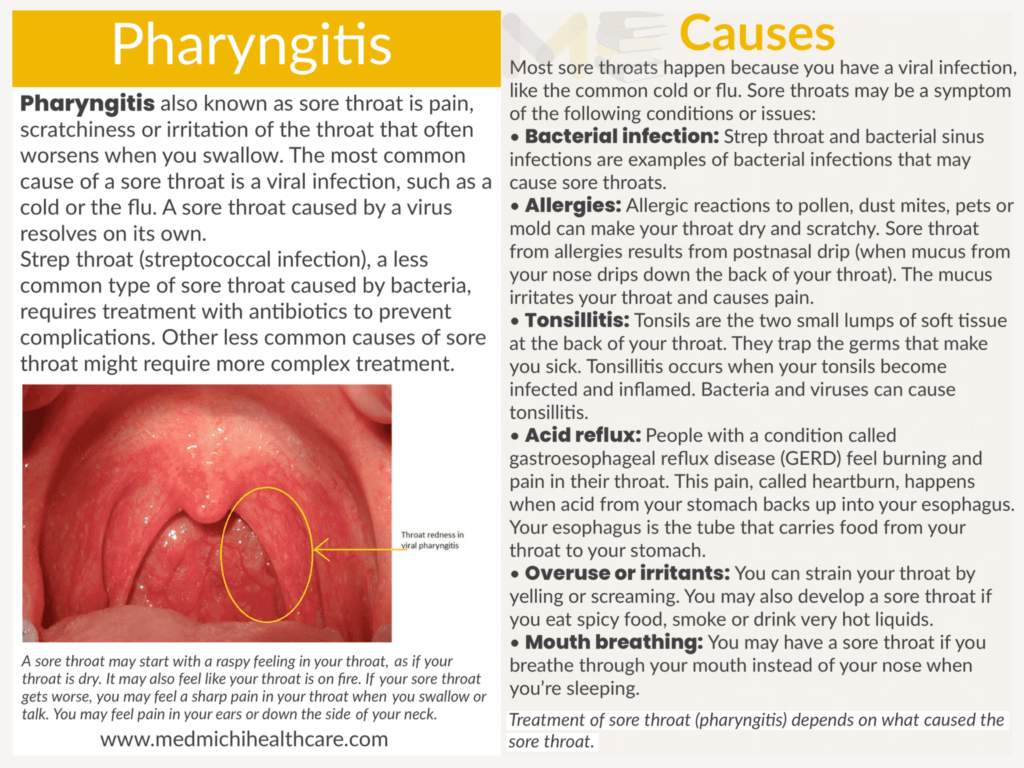 Pharyngitis 