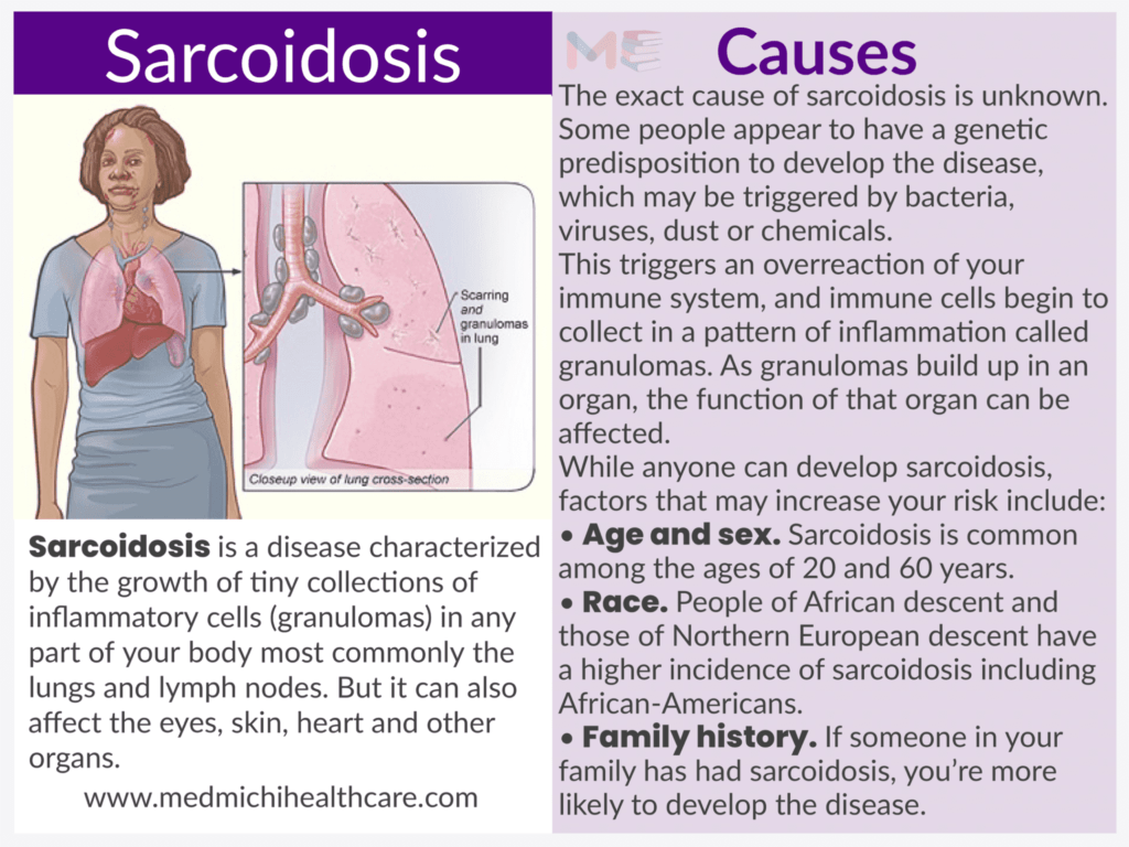Sarcoidosis 