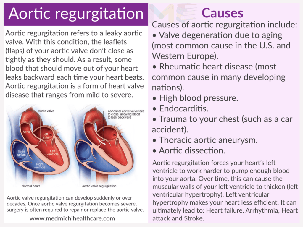 All Disease Causes Short Notes 5 Aortic regurgitation 