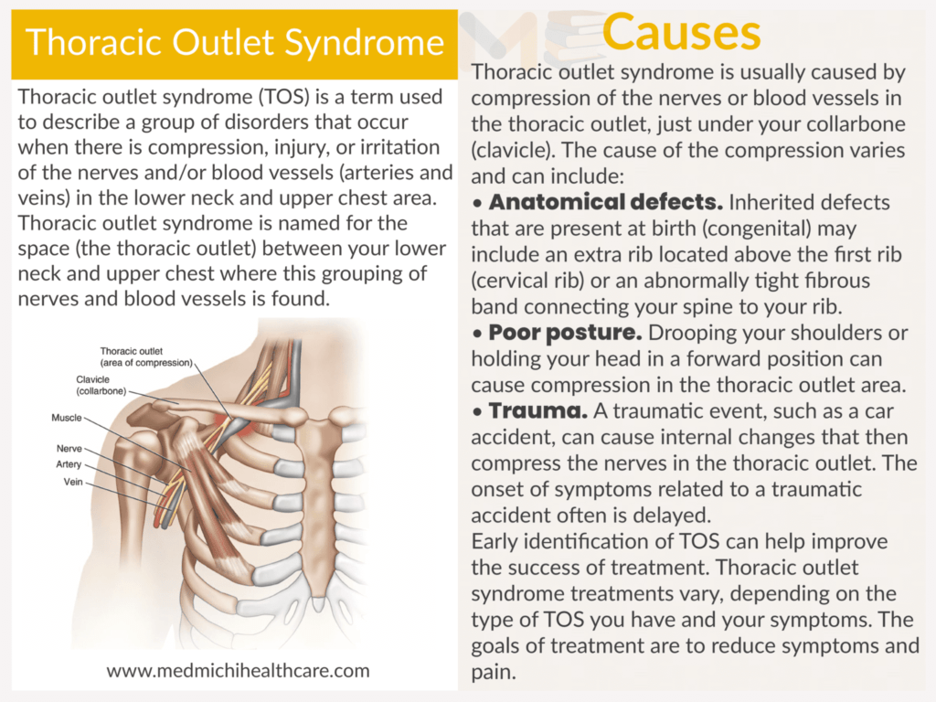 Thoracic outlet syndrome ​