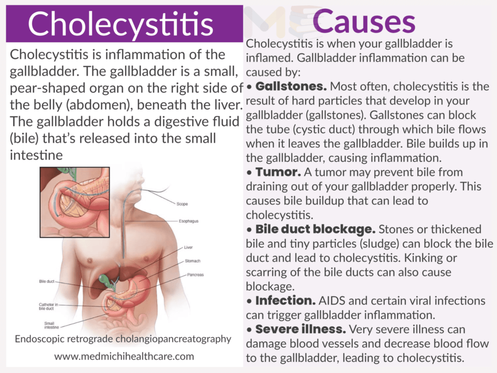 Cholecystitis​