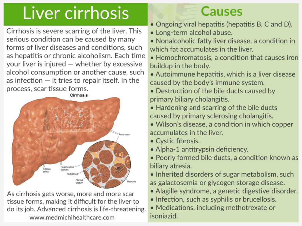 All Disease Causes Short Notes 25 Liver cirrhosis