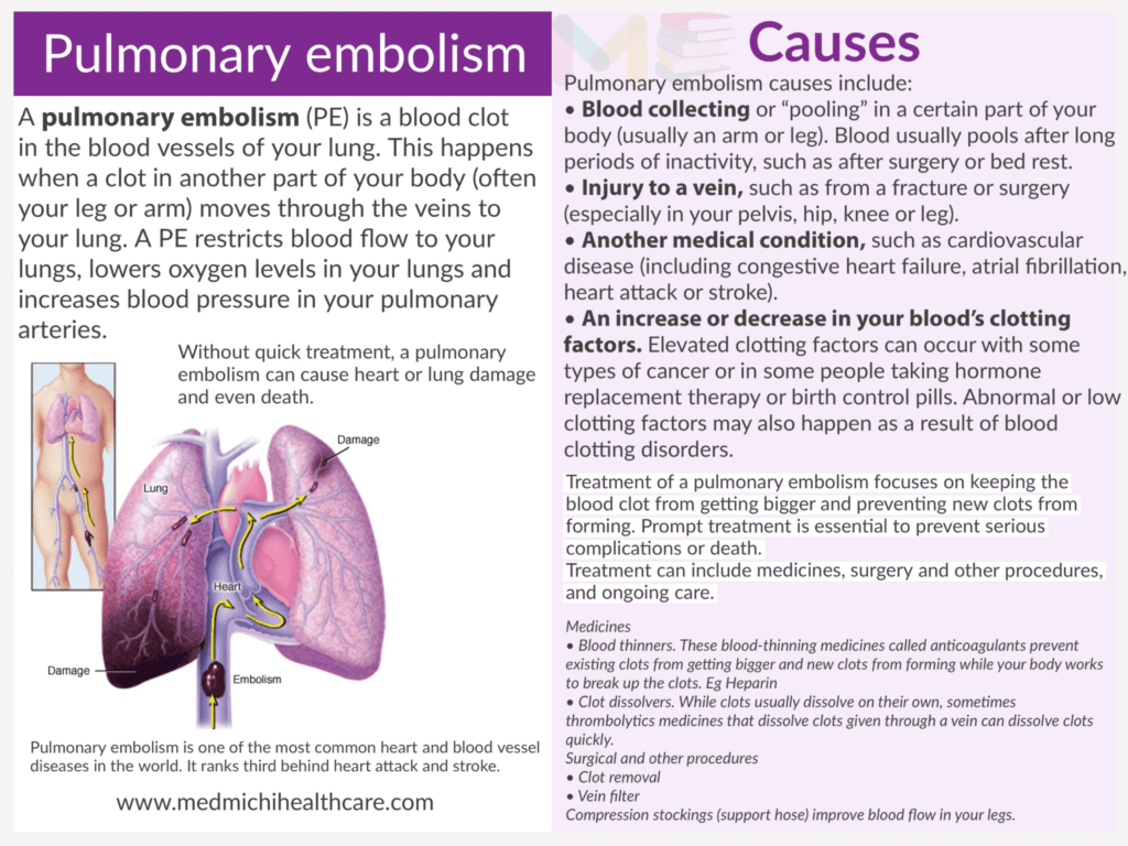 Pulmonary embolism 
