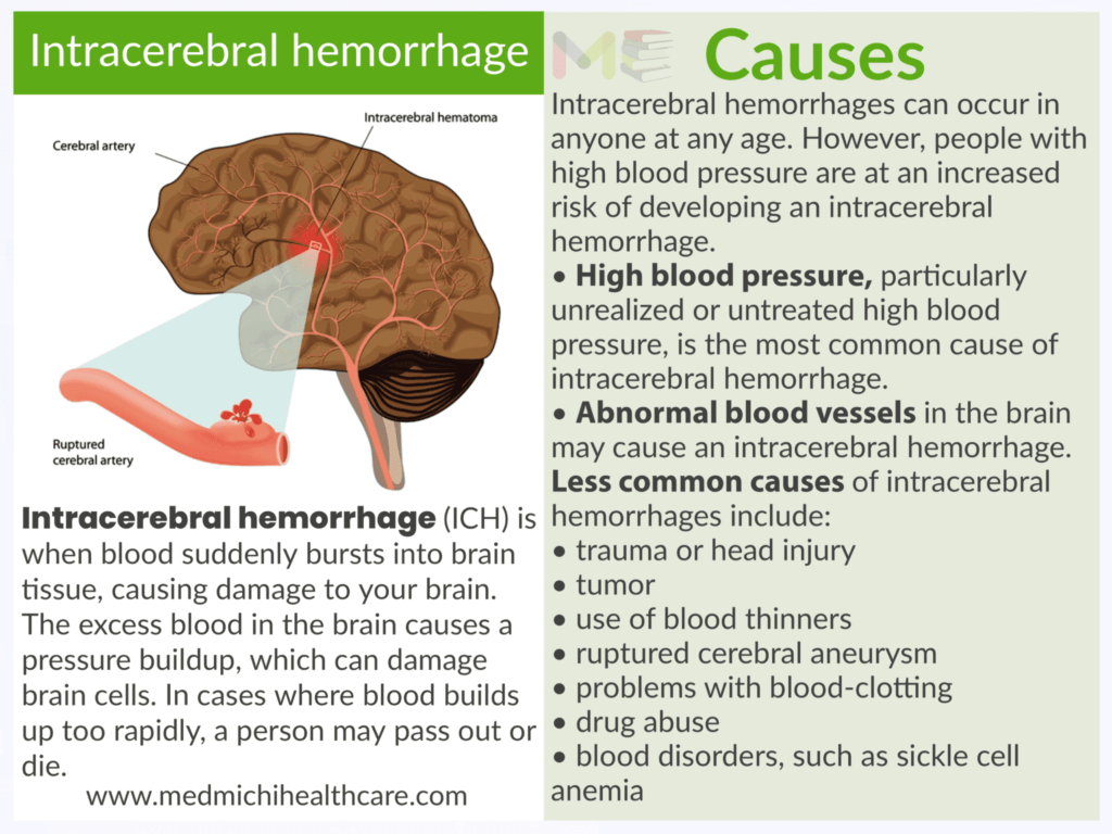 Intracerebral hemorrhage ​