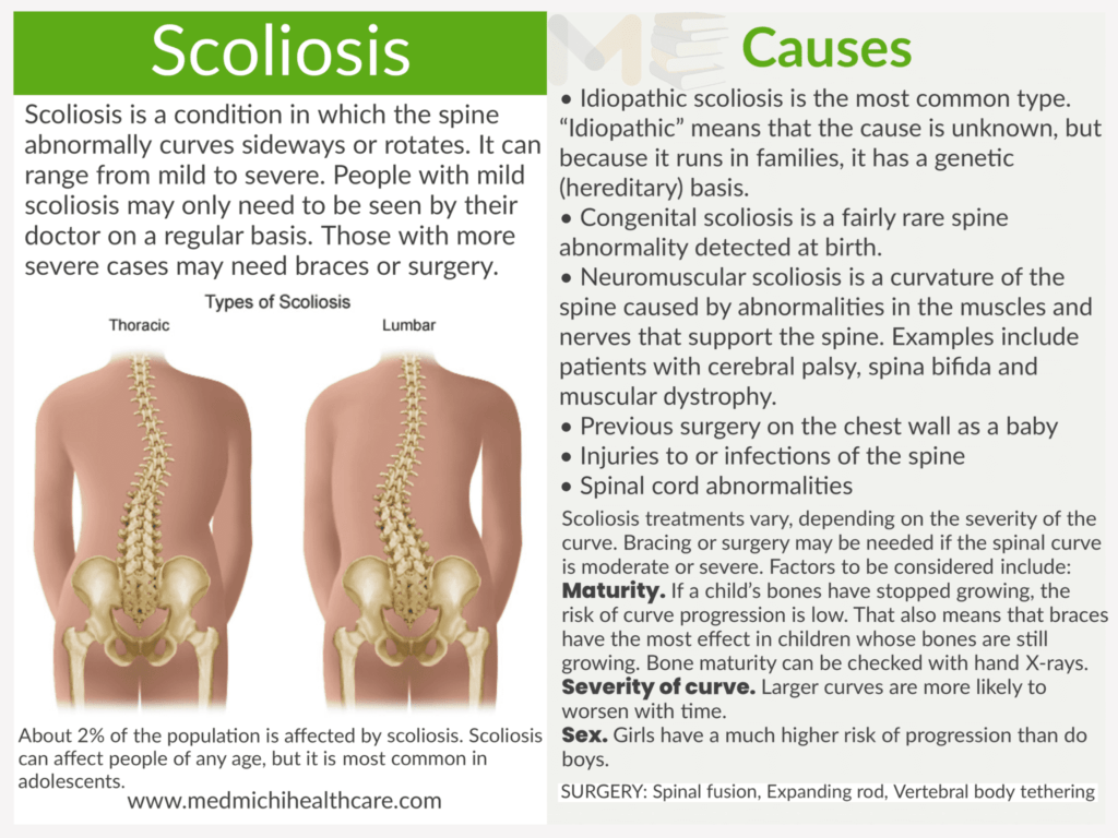 Scoliosis 