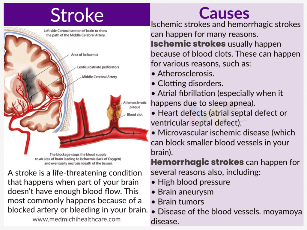 All Disease Causes Short Notes 19 Stroke