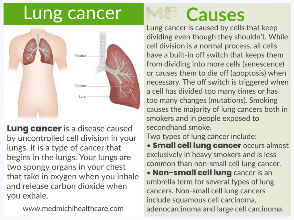 All Disease Causes Short Notes 14 Lung cancer