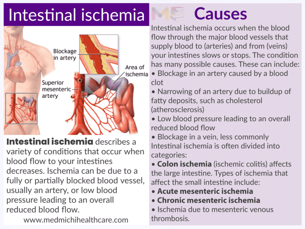 Intestinal ischemia 