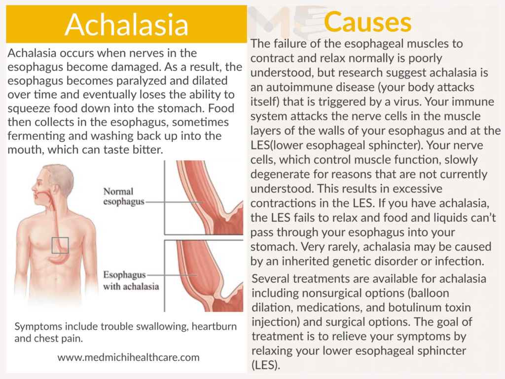 Achalasia ​