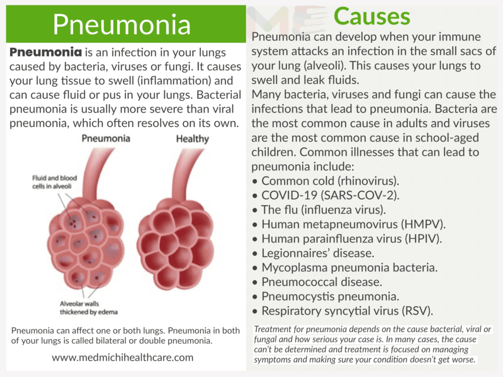 All Disease Causes Short Notes 7 Pneumonia