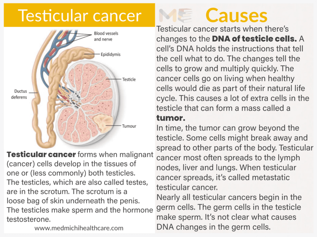 Testicular cancer​