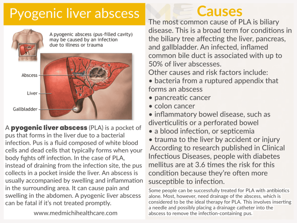Pyogenic liver abscess ​