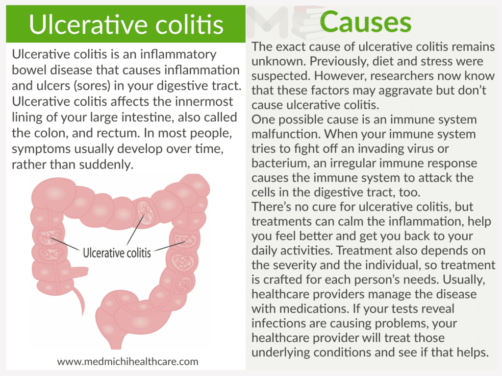 Ulcerative colitis 