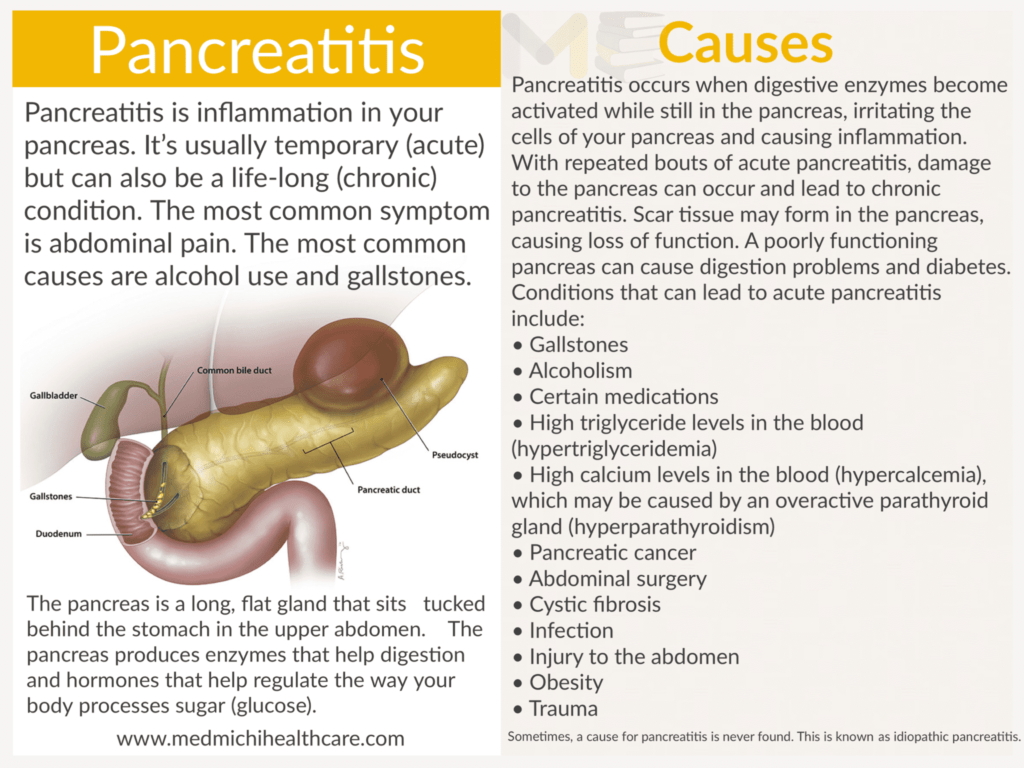 Pancreatitis 