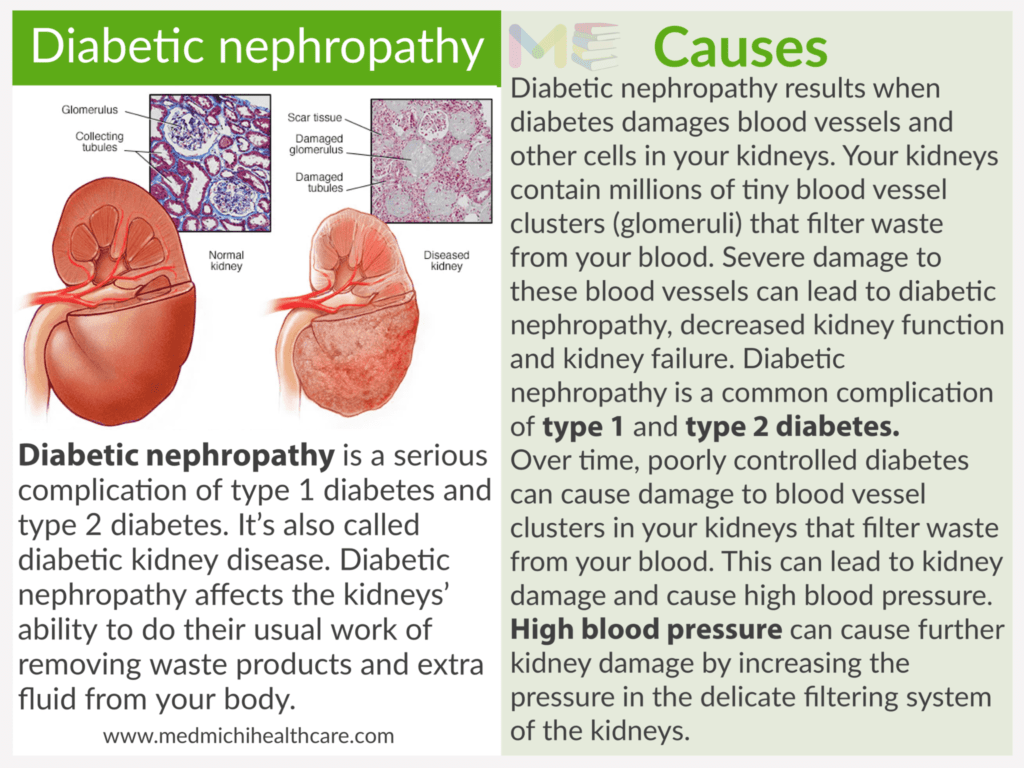Diabetic nephropathy ​