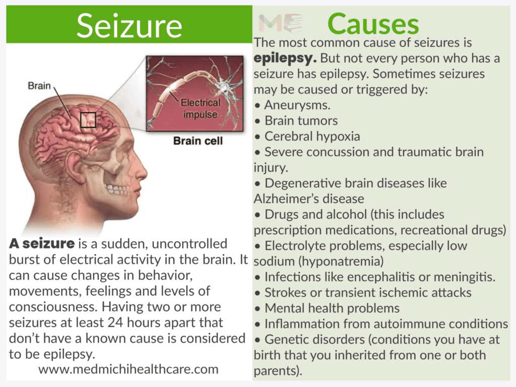 Seizure 