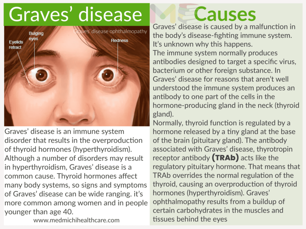 Graves’ disease ​