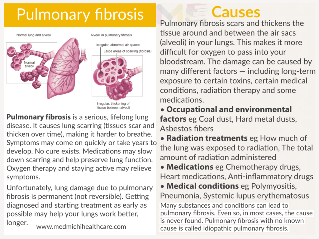 Pulmonary fibrosis 