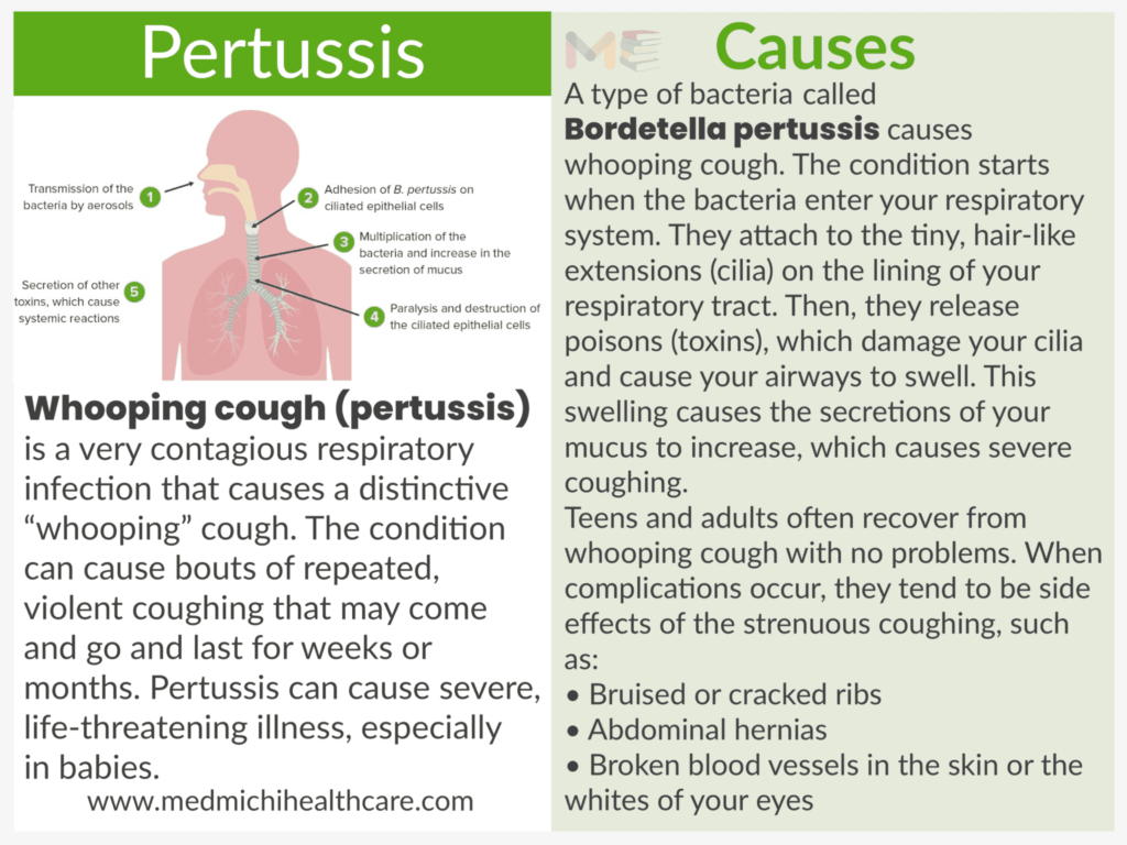 Pertussis