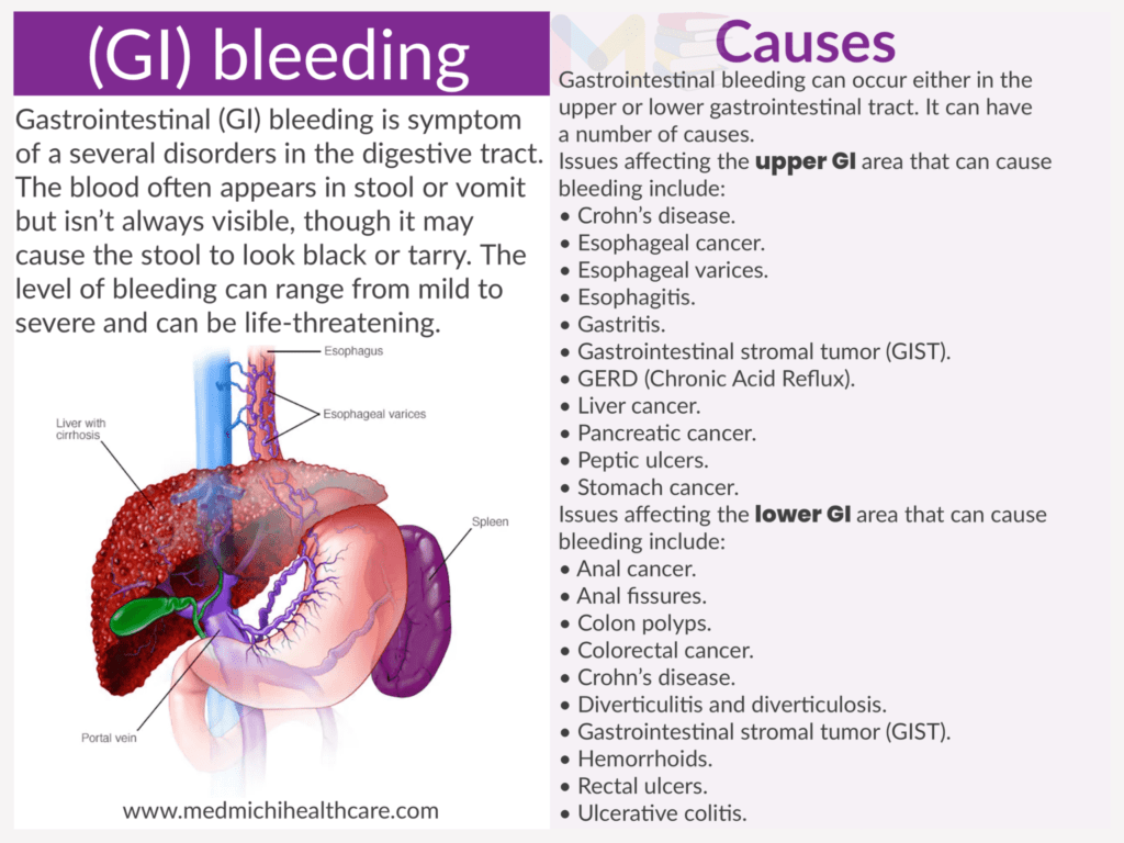 Gastrointestinal bleeding​