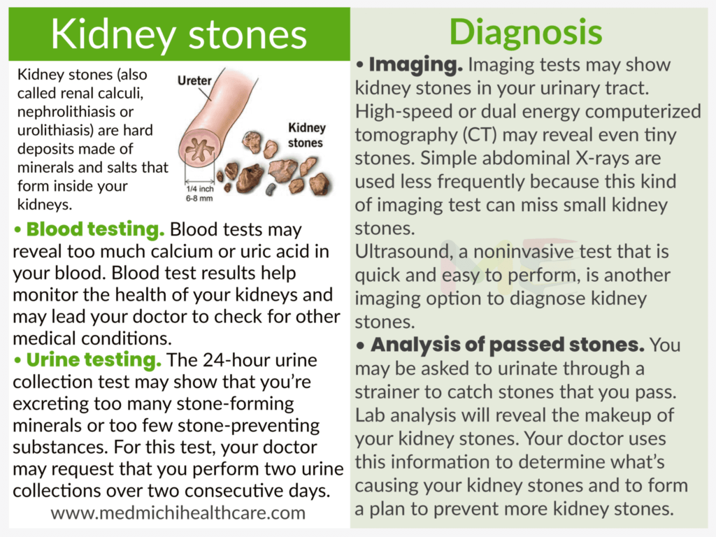 Kidney stone 