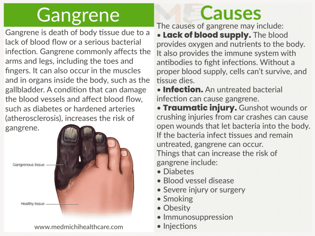 Gangrene 